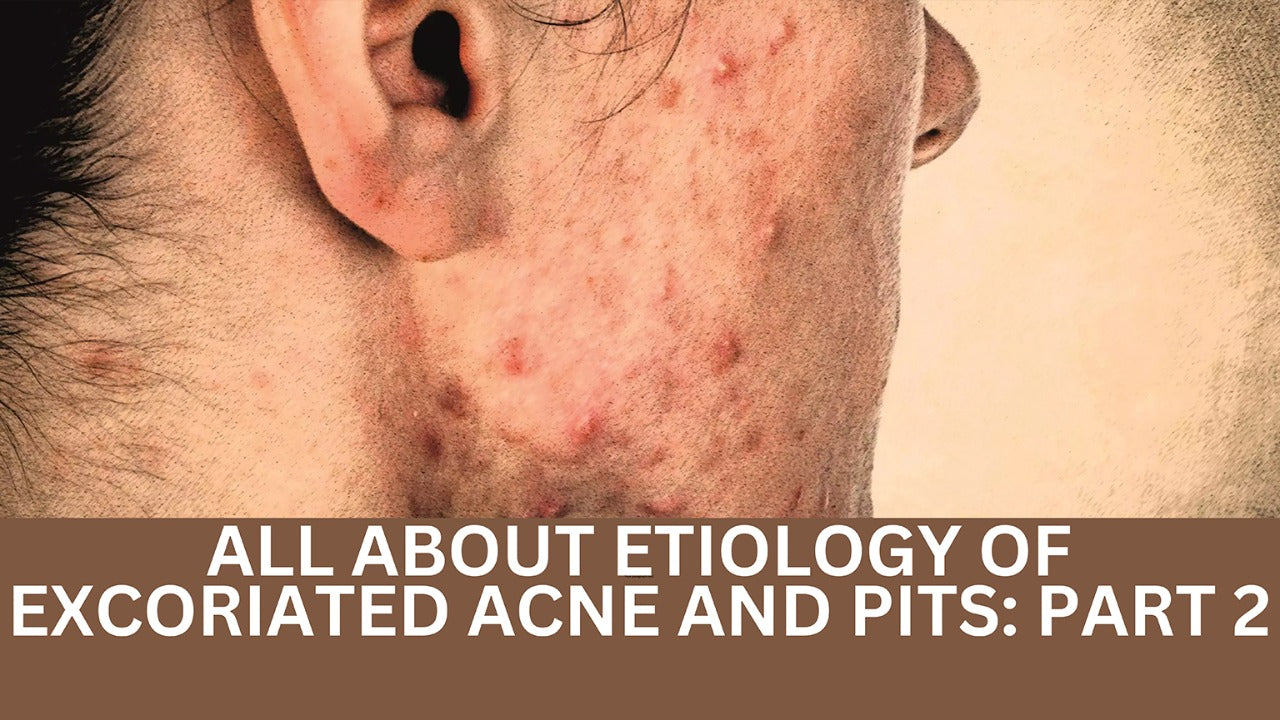 ALL ABOUT ETIOLOGY OF EXCORIATED ACNE AND PITS: PART 2