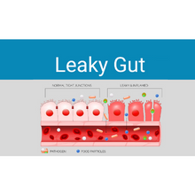 What Is Gut? What Is Leaky Gut?