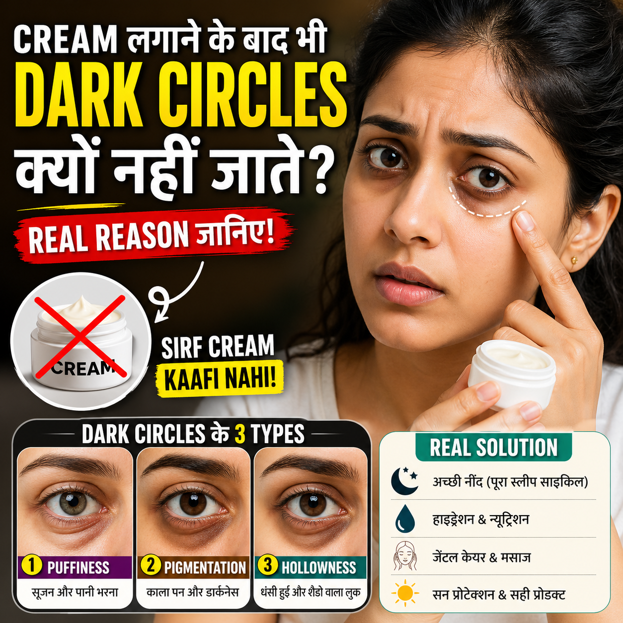 What is the real reason of Dark Circles? – Aankhon Ke Neeche Kaale Ghere Ka Asli Karan Kya Hai?