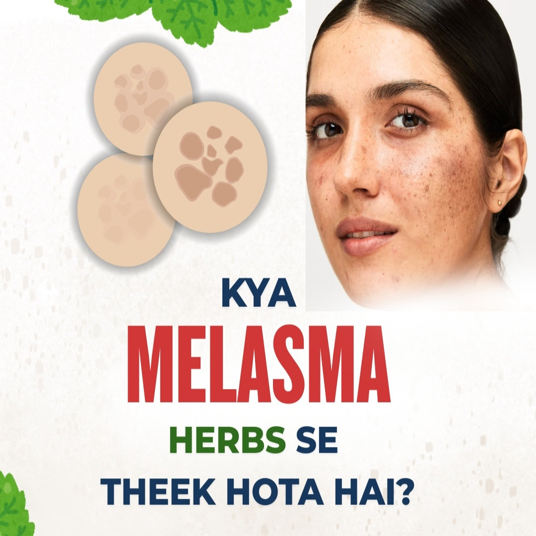 Can Melasma Be Treated with Herbs? Understanding the Real Cause of Melasma