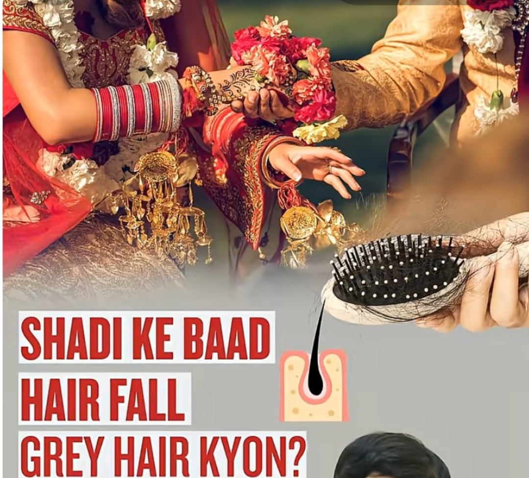 Hair Fall Solution: Why Hair Fall Starts After Marriage and the Role of Sindoor
